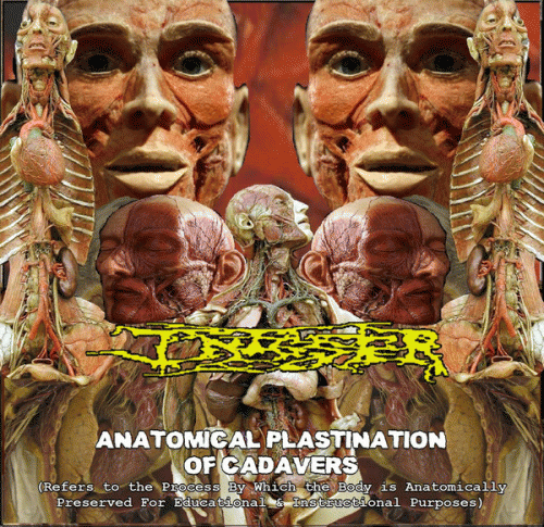 Infester (USA-2) : Anatomical Plastination of Cadavers (Refers to the Process by Which the Body Is Anatomically Preserv